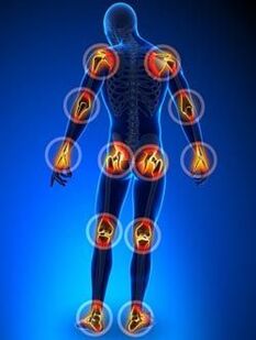 Localization of the joints affected by arthrosis
