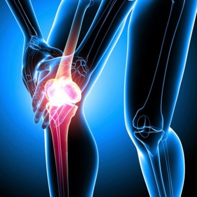 In the advanced stage, rheumatoid arthritis can cause thigh pain
